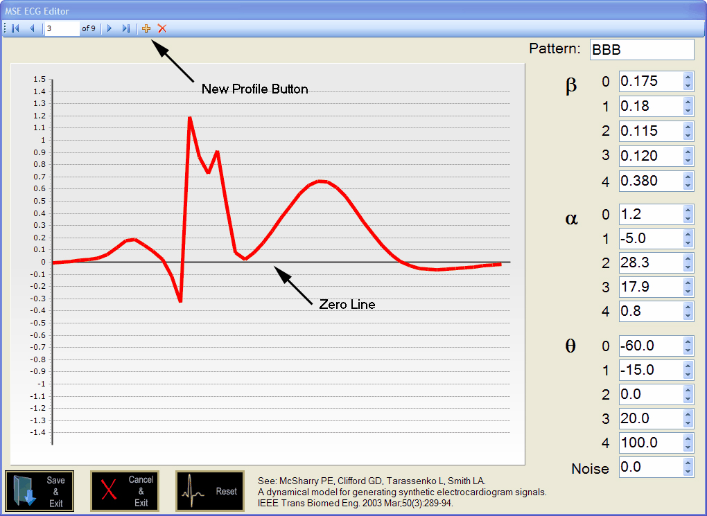 ECG Editor