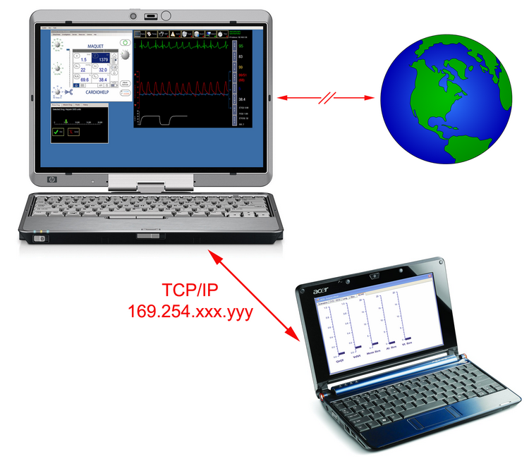 MSE Netbook APIPA