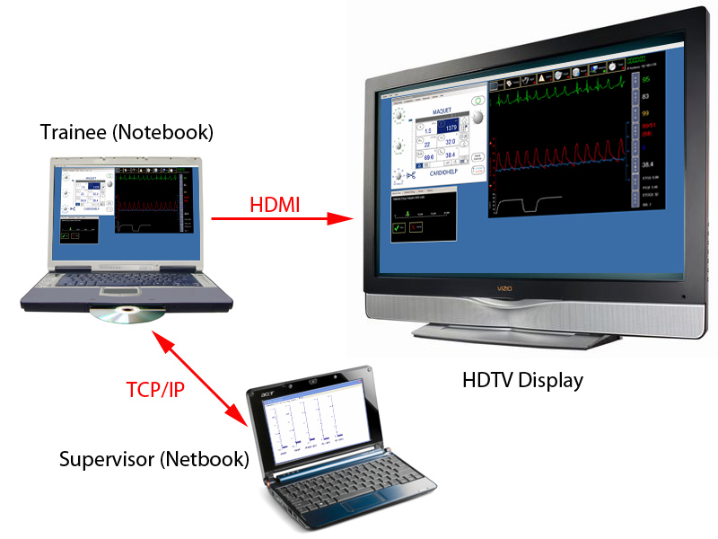 System Equipment