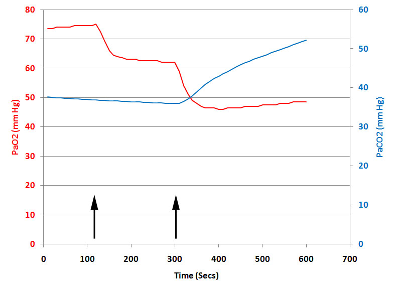 Effect Of FiO2